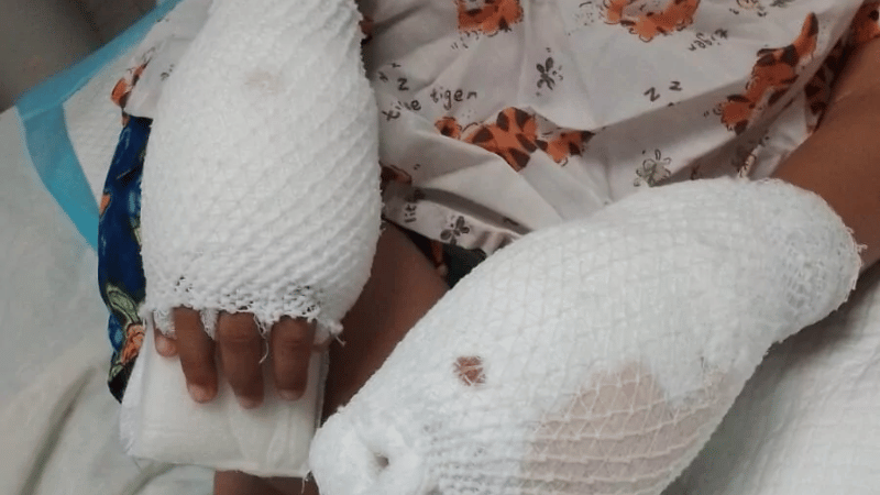 Aplazan nuevamente audiencia de medida de coerción contra madre acusada de quemar manos de su hijo