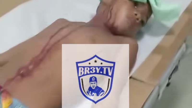 Video: Indignación en el Hospital Moscoso Puello: Niño herido no recibe atención por falta de personal en emergencia