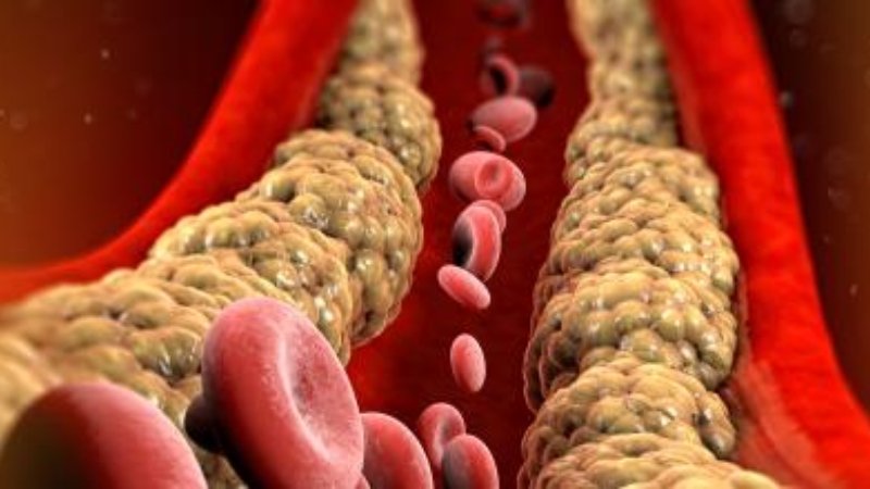 El colesterol alto: un enemigo silencioso que podemos vencer desde la infancia