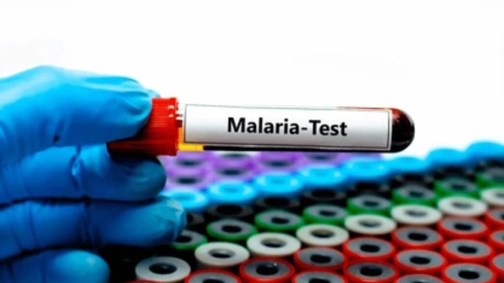 Epidemiología reporta 874 casos de malaria en el país y confirma que la mayoría son autóctonos